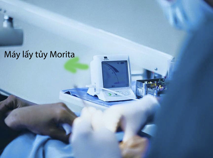 HÚT TỦY CÔNG NGHỆ MORITA